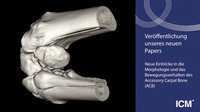 Das ACB (Accessory Carpal Bone) ist ein wichtiger Knochen im Karpalgelenk